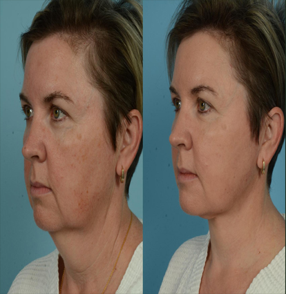 Surgery & Recovery Support